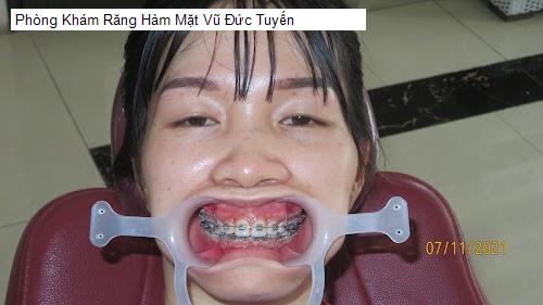 Phòng Khám Răng Hàm Mặt Vũ Đức Tuyến