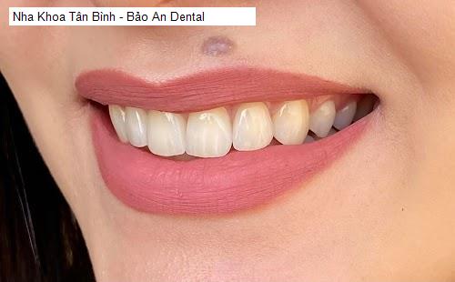 Nha Khoa Tân Bình - Bảo An Dental